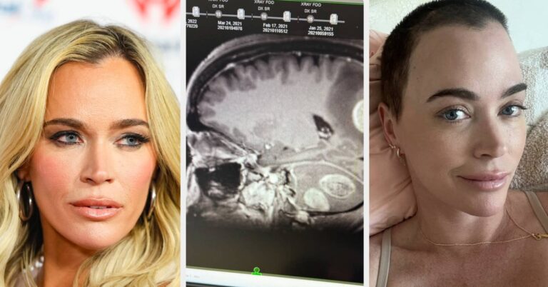 “Real Housewives” Star Teddi Mellencamp Reveals She's Been Diagnosed With More Brain Tumors And Is Still Undergoing Treatment