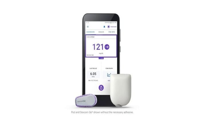 Automated Insulin Delivery Systems : Automated Insulin Delivery
