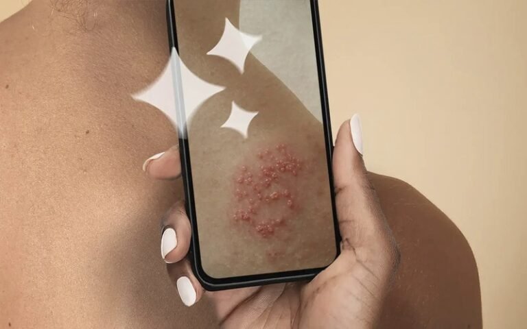 Boots Online Doctor SmartSkin Checker