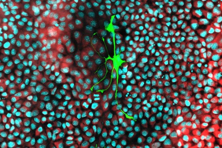 Cancer cells steal mitochondria from nerve cells to fuel their spread