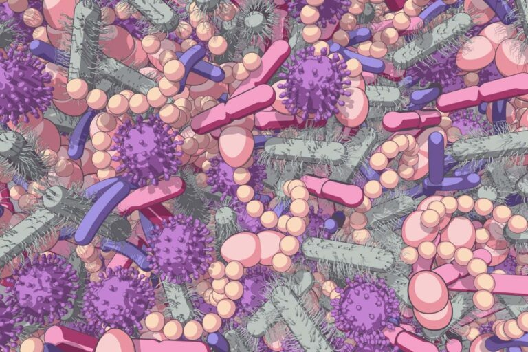 Altered gut microbiome linked to fertility issues in people with PCOS