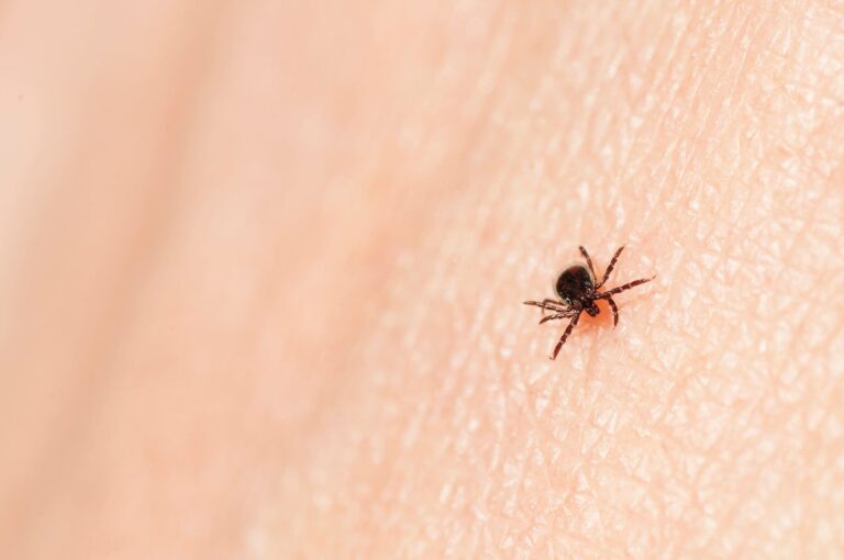 Why Ticks and Lyme Disease Are Soaring This Summer