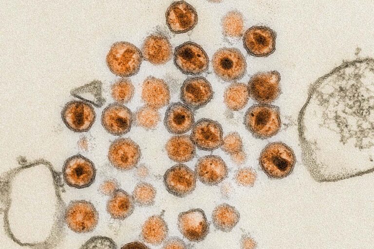 Human trials point the way towards an mRNA vaccine against HIV