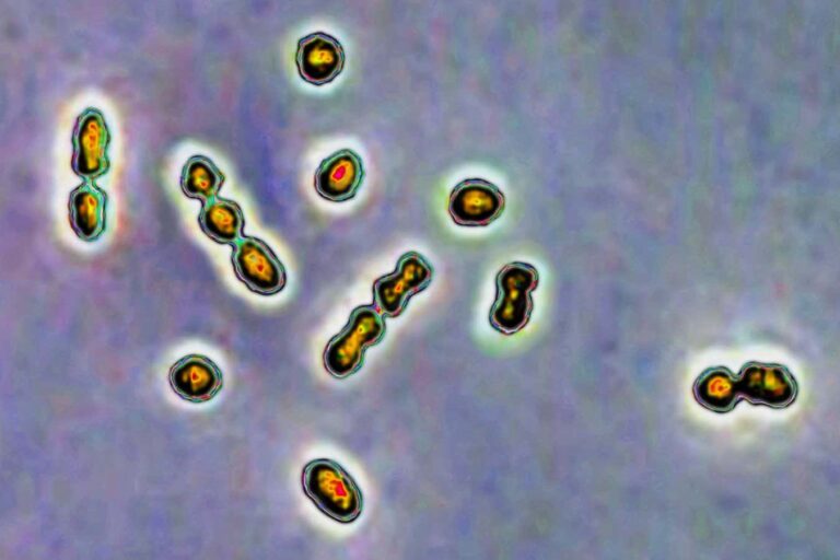 Human milk could help fight infections that endanger pregnancies