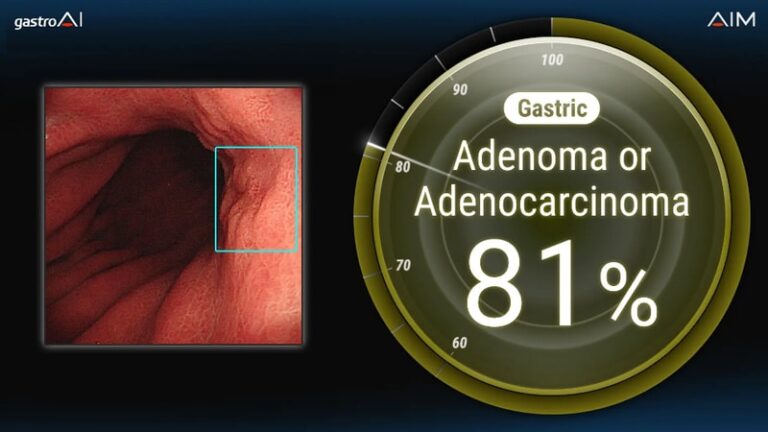 Endoscopic AI Innovations : AI Medical Service