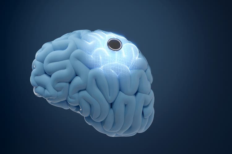 Neuralink eyes $1B annual revenue by 2031 – report (TSLA:NASDAQ)