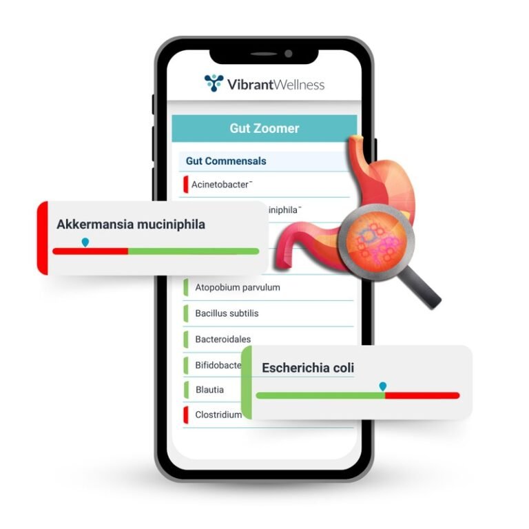 Revamped Gut Microbiome Tests : microbiome test