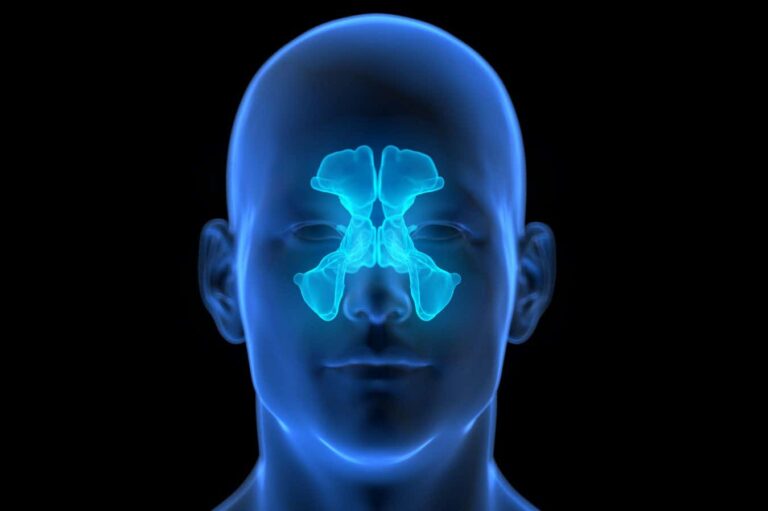 Go-to therapy for chronic sinus condition doesn’t work that well