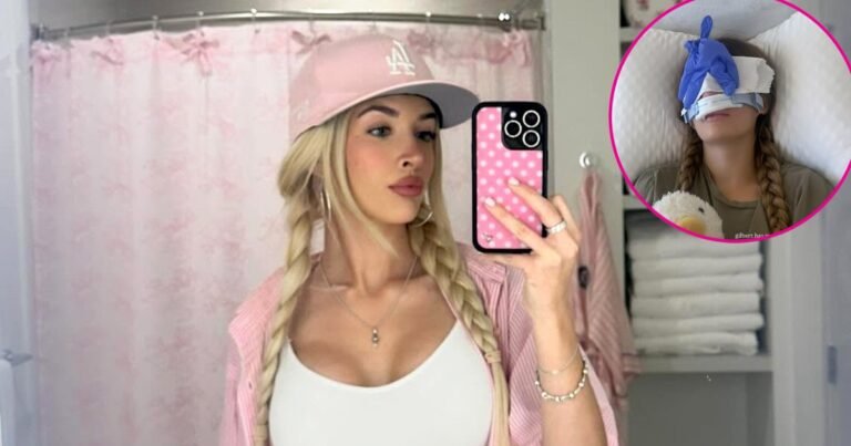 Sami Sheen Reflects on Rhinoplasty 1 Year Later: ‘Best Decision’