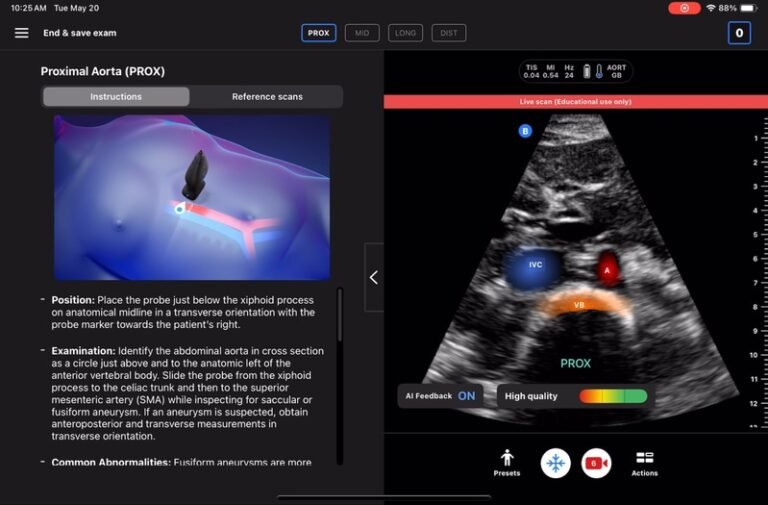 AI-Enhanced Ultrasound Technologies : Butterfly Network
