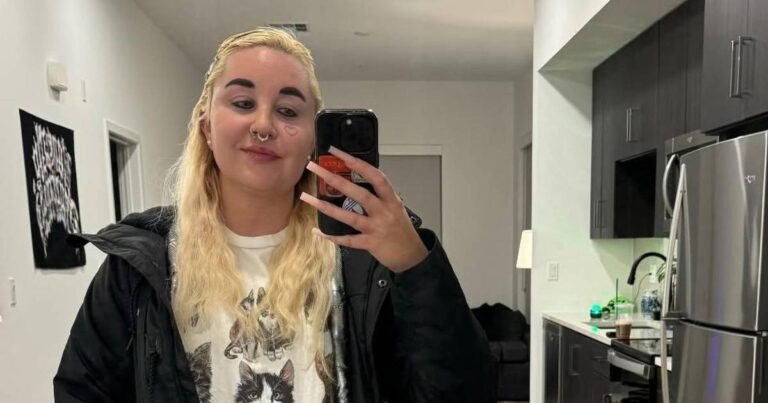 Amanda Bynes Steps Out With Two-Toned Hair After Getting Lip Filler