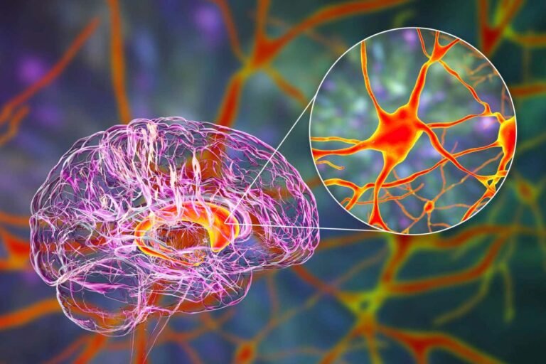 Huntington’s disease breakthrough: what to know about the gene therapy