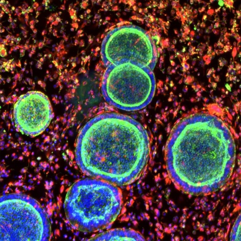 Lab-Grown Organoids Could Transform Female Reproductive Medicine