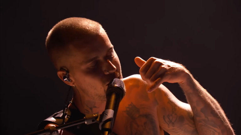 Justin Bieber Hair Transplant Rumors SURGE After Grammys