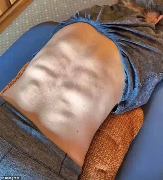 US Olympic star Mikaela Shiffrin shows off incredible six-pack… on her BACK