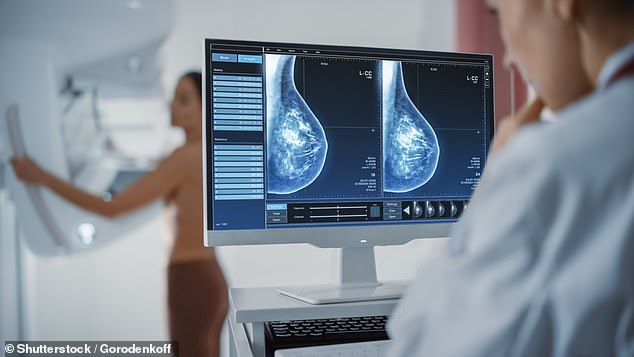 Almost 1 in 3 women snub life-saving breast screening despite catching 20,000 cancers last year