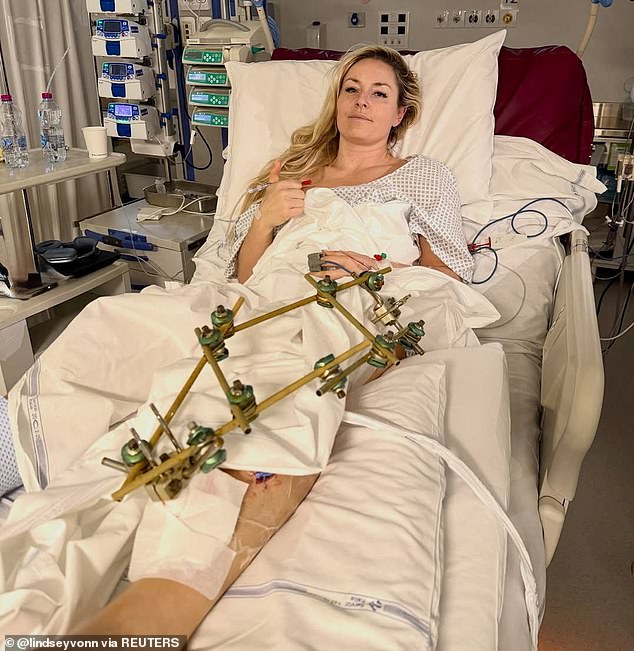 Lindsey Vonn hits back at ‘haters’ from her hospital bed after being told she was ‘selfish’ to take Olympic spot ahead of horror leg break aged 41