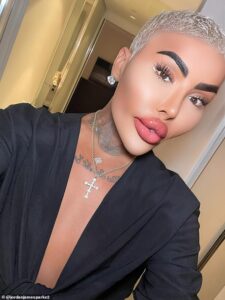 Kim Kardashian-obsessed ‘Lip King’ dies a year after he was arrested over death of mother-of-five who passed away following BBL at his clinic