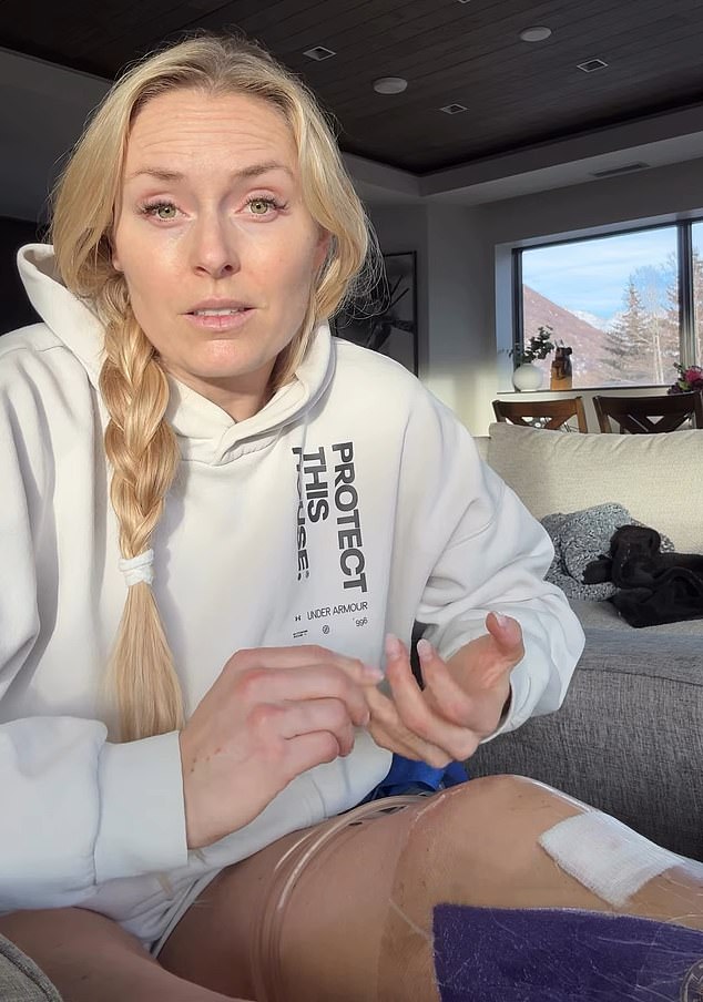 Lindsey Vonn finally leaves hospital after Winter Olympics horror crash and reveals how doctor ‘saved her leg’ from amputation