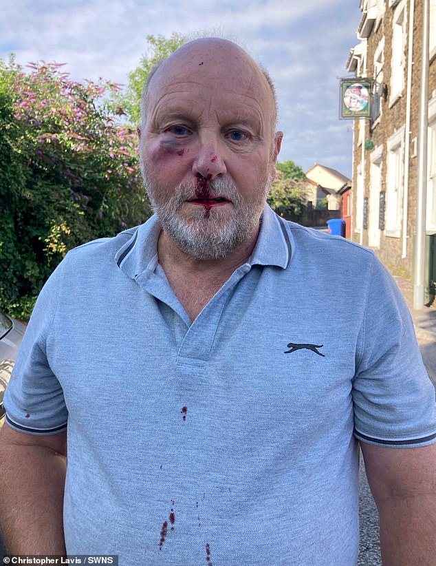 Road rage van driver who fractured grandfather’s cheek and eye socket when he punched him for obeying 20mph speed limit avoids prison