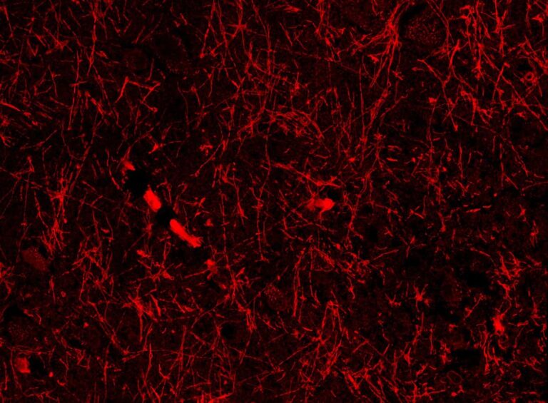 Accidental discovery hints at mystery structures within our brain