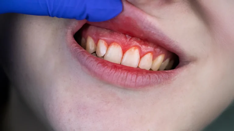 This common tomato nutrient may help prevent severe gum disease