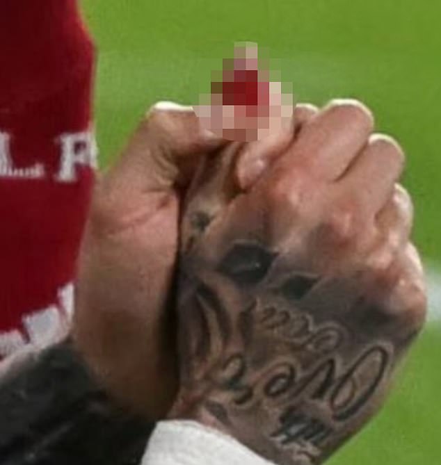 Galatasaray star left in agony and needing oxygen after slicing finger open in freak accident involving advertisement hoardings during Champions League clash with Liverpool at Anfield