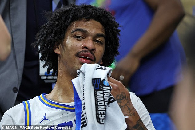 March Madness star loses his TOOTH after sickening elbow to the face… before his teammate finds it on the court