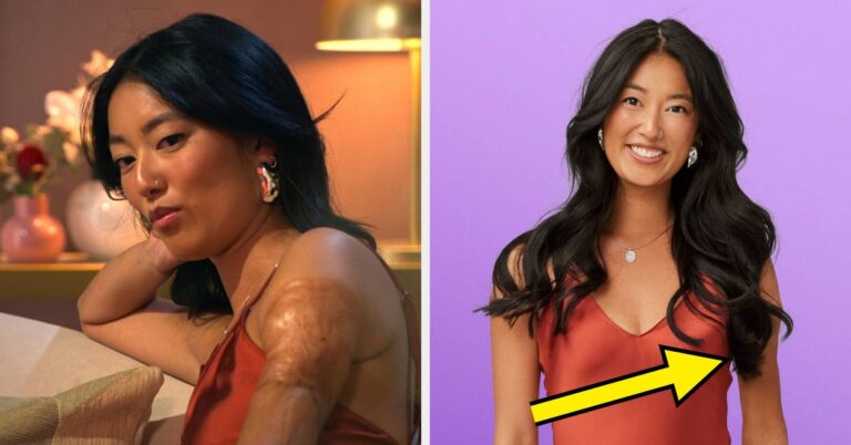 After Netflix Faced Major Backlash For Seemingly Editing “Love Is Blind” Star Emma Betsinger’s Scarring Out Of Promotional Photos, Here’s How She Responded