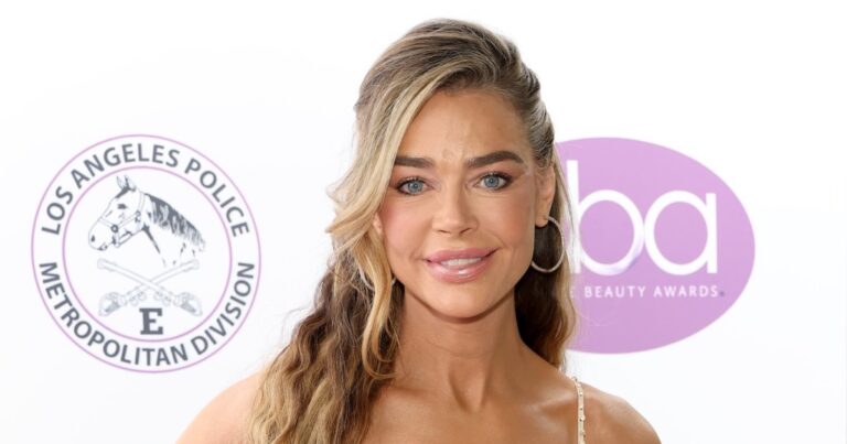Denise Richards Reveals Before-and-After Facelift Photos