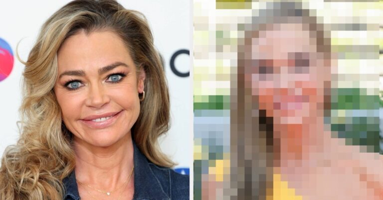 Denise Richard Posts Facelift Results