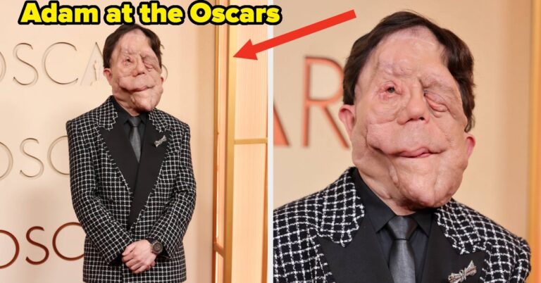 After A Comedian Made Fun Of His Appearance At The Oscars, Adam Pearson Responded Perfectly