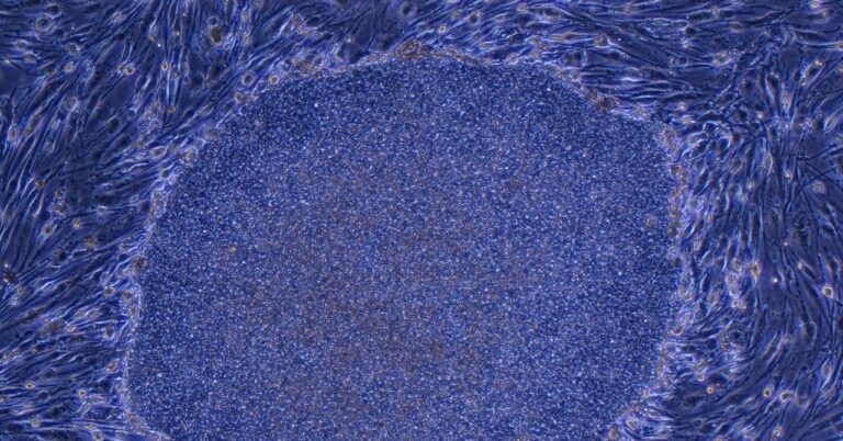 Japan Approves the World’s First Treatment Made With Reprogrammed Human Cells