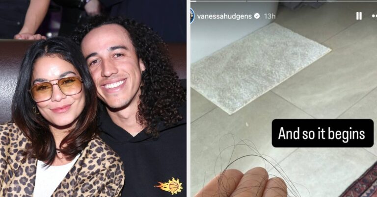 Months After Giving Birth To Her Second Child, Vanessa Hudgens Showed How She’s Been Impacted By Postpartum Hair Loss