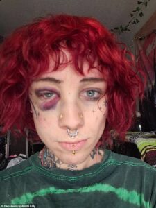 Utah concert for SOBER goths descends into bloody violence…as trans woman is left with a black eye