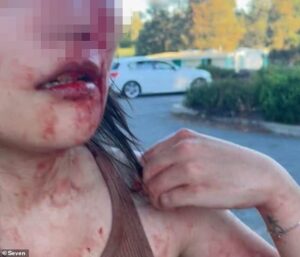 Canberra on edge after woman randomly bashed and threatened with a knife by another female in vile racist attack