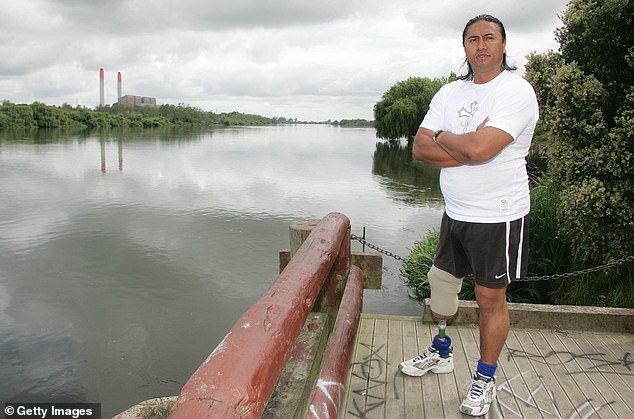 Footy star’s SHOCKING admission after motorbike accident robbed him of his leg