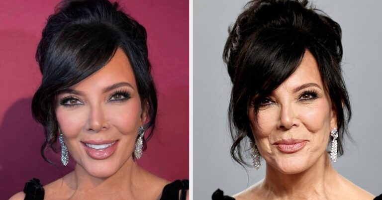 Here’s What A Board-Certified Physician Had To Say About The “Perils Of Photoshop” After Comparing Kris Jenner’s Instagram Selfies With Her Unedited Red Carpet Pictures