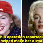 17 Old Hollywood Stars Before And After Cosmetic Surgery
