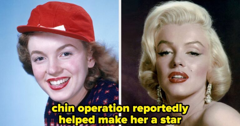 17 Old Hollywood Stars Before And After Cosmetic Surgery