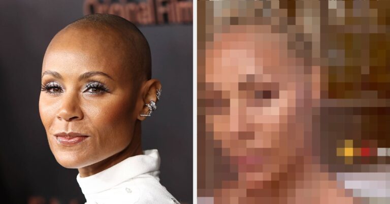 After People Accused Jada Pinkett Smith Of Lying About Having Alopecia When She Showed Off Her Hair Regrowth, An Expert Shared A Very Important Reminder