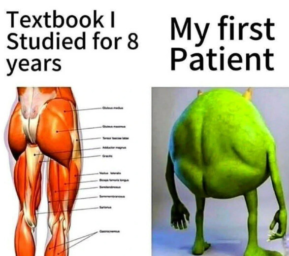 This is pure brainrot.