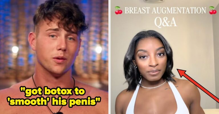 32 Famous People Talk Plastic Surgery