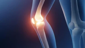 Scientists reveal the best exercise for knee arthritis pain relief