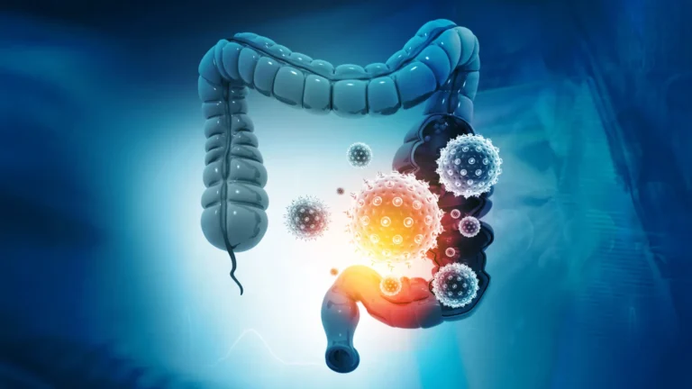 What’s hiding inside colon cancer could change treatment