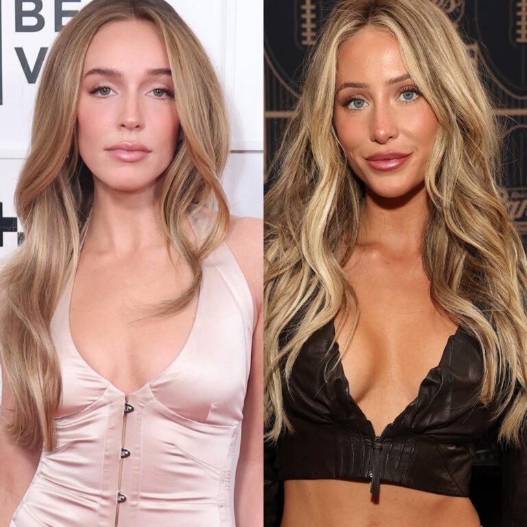 Alex Cooper, Alix Earle Feud Explained: What They Said