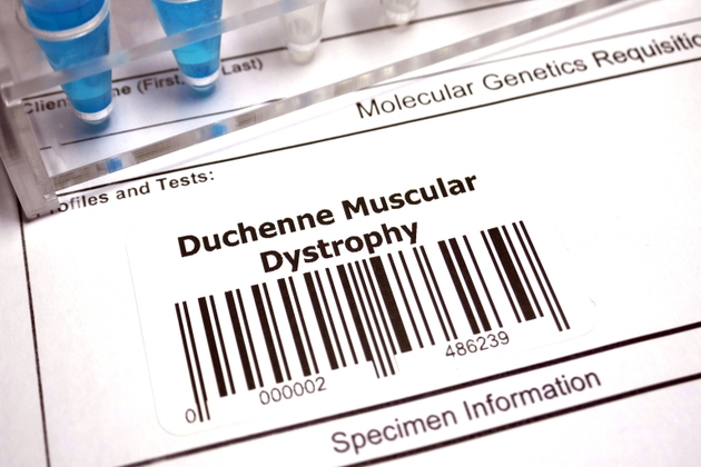 Sarepta/ Roche Duchenne therapy to face new late-stage trial targeting EU nod