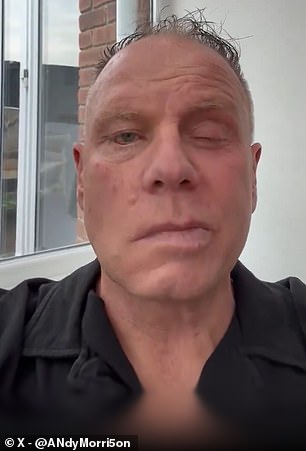 Former Man City captain, 55, opens up on health battle after being diagnosed with devastating neurological condition