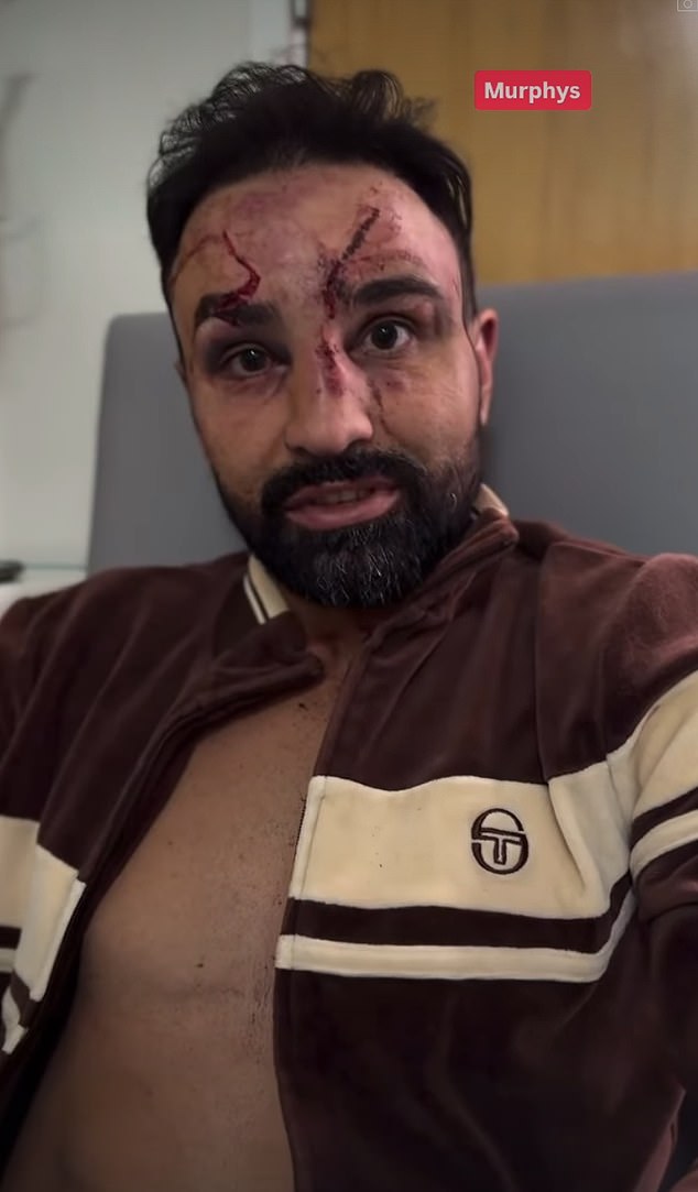 NHS hospital responds to American bare-knuckle boxer after he attacked staff who ‘wouldn’t be allowed to work on farm animals’ in the US in shocking rant about his health treatment – and he is fighting in the UK again this weekend!