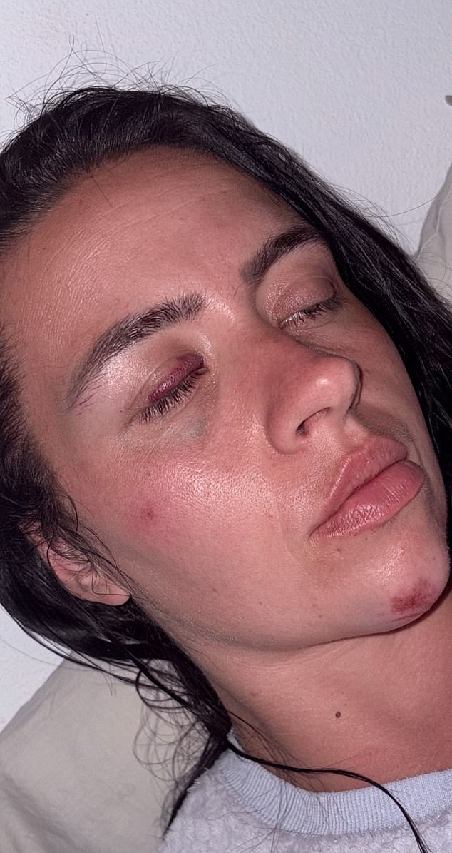 British mother pleads for help after ‘abusive’ Turkish ex ‘kidnaps their toddler son’ in Cyprus